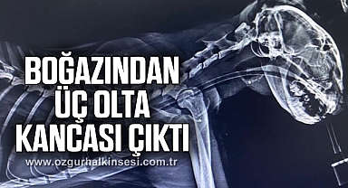 Boğazından üç olta kancası çıktı