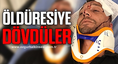 ÖLDÜRESİYE DÖVDÜLER