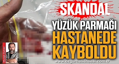 YÜZÜK PARMAĞI HASTANEDE KAYBOLDU