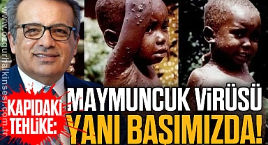 MAYMUNCUK VİRÜSÜ YANI BAŞIMIZDA!