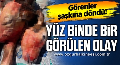 Komşuda yüz binde bir görülen olay
