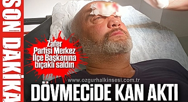 Dövmecide kan aktı
