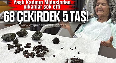 Yaşlı Kadının Midesinden çıkanlar şok etti: 68 Çekirdek 5 taş!