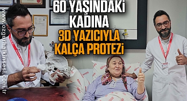 60 Yaşındaki Kadına 3D Yazıcıyla Kalça Protezi
