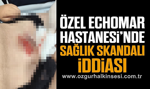 ÖZEL ECHOMAR HASTANESİ’NDE SAĞLIK SKANDALI İDDİASI